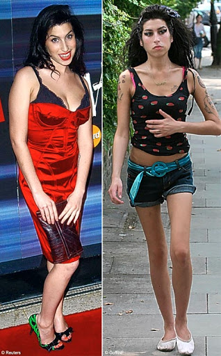 Amy Winehouse: The Before and After of Drugs and Alcohol